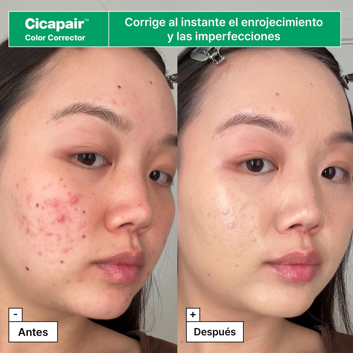 CICAPAIR™ REDNESS RESCUE REGIMEN KIT WITH CENTELLA ASIÁTICA (SET PARA CUIDADO DE LA PIEL)